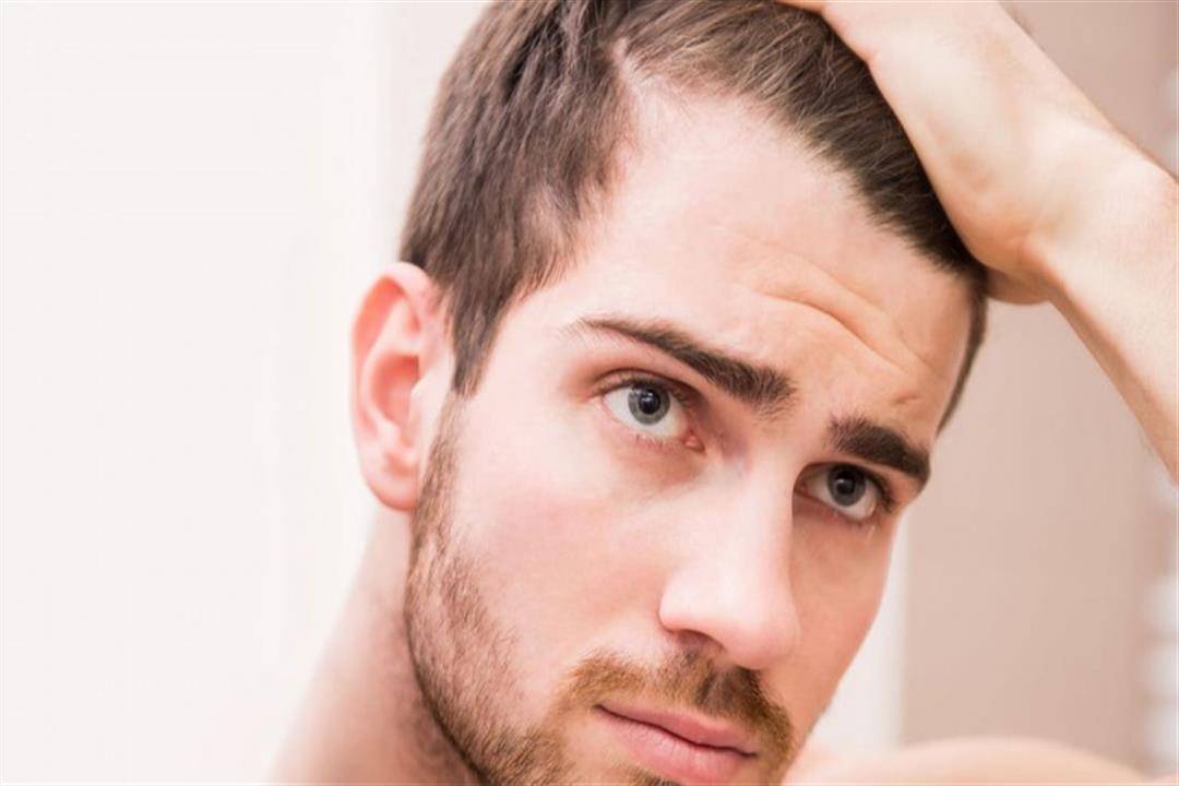 أغربها الكركديه.. 7 علاجات بديلة لتساقط الشعر عند الرجال (صور) أغربها الكركديه.. 7 علاجات بديلة لتساقط الشعر عند الرجال (صور)