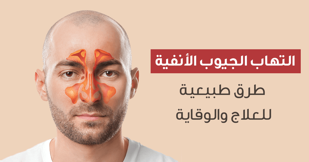 التهاب الجيوب الأنفية